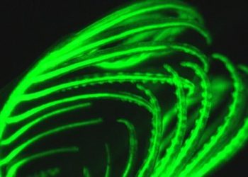 Man suffers life-threatening injury after fall from La Jolla cliff