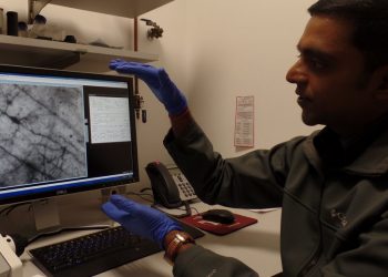 Diabetes can lead to Alzheimer’s disease, La Jolla researchers find