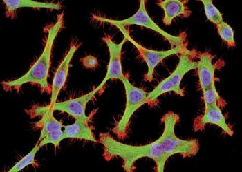 UCSD researcher trains lens on mysterious eye