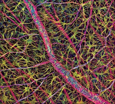 Deerinck uses light photography technology to unravel secrets of childhood blindness