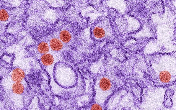 First sexually transmitted Zika virus case reported in San Diego