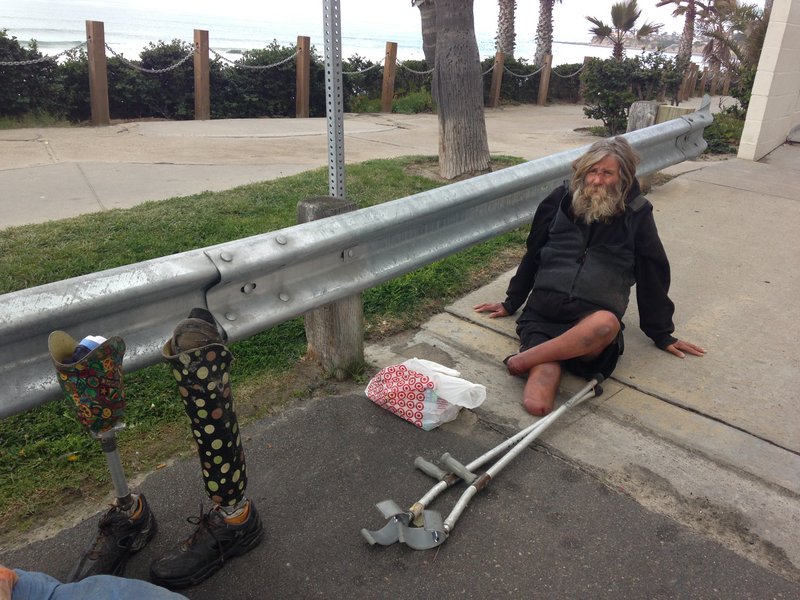 Writer calls lifeguard’s treatment of homeless amputee overzealous