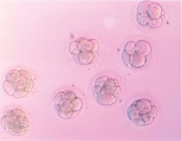 La Jolla doctor sees the potential in every infertility case