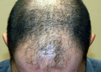 Pacific Highway Economy Lot at San Diego Airport to close Dec. 26